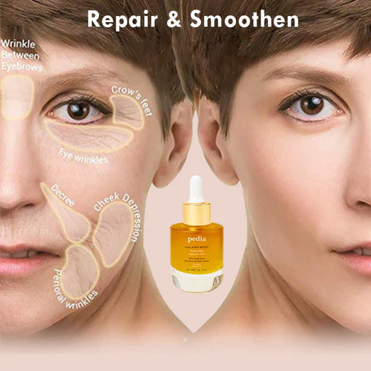 Pedia™ Advanced Collagen Boost Anti Aging Serum🔥( Limited time discount Last 30 minutes)