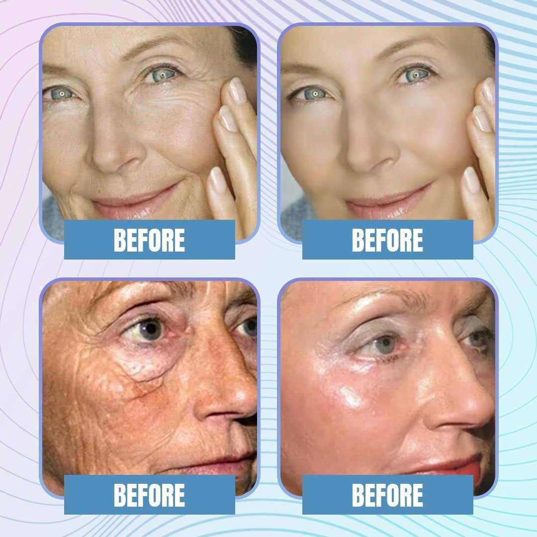 Hyaluronic Acid Microcrystalline Lifting Decree Patch