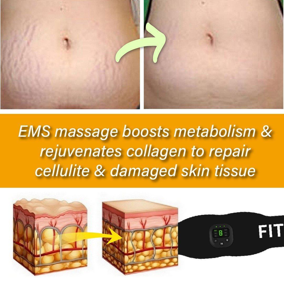 SmartFitness™ Fat & Cellulite Reduction EMS Belt