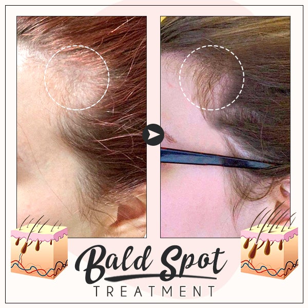 RevivePro™ Hair Boost Ginger Cream