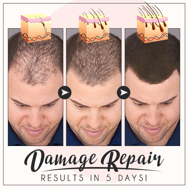 RevivePro™ Hair Boost Ginger Cream