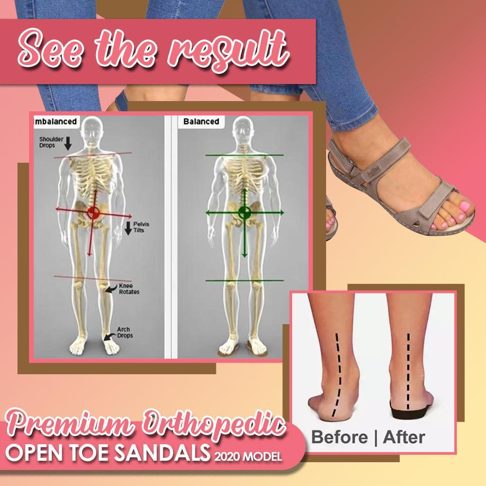⭐$19.99 Last 2DAYS⭐Premium Orthopaedic Open Toe Sandals - 2020 MODEL
